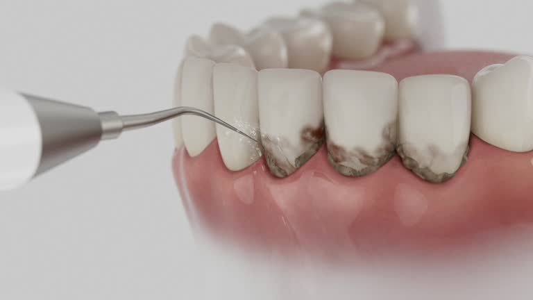 Reliable Dental Implants contractor in Swift Trail Junction, AZ by Smile Center Dentistry